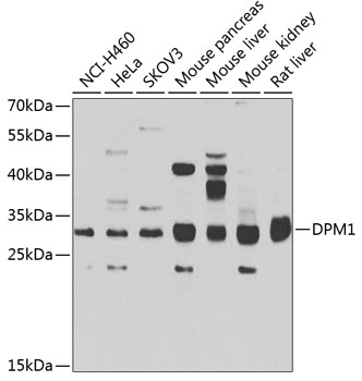 a05597 dpm1 primary antiboties wb testing 1