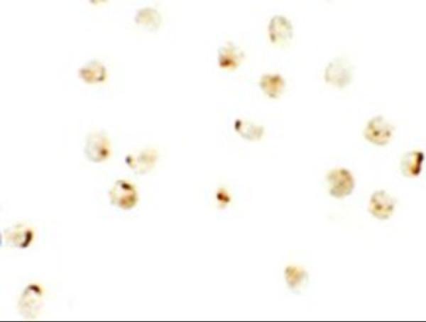 a05598 1 irf2bp2 primary antibodies icc testing 2