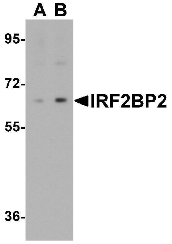 a05598 1 irf2bp2 primary antibodies wb testing 1