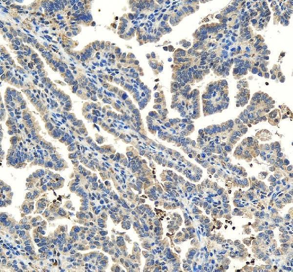 IHC analysis of ODF2 using anti-ODF2 antibody (A05599-3)