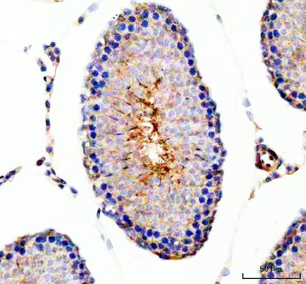 IHC analysis of ODF2 using anti-ODF2 antibody (A05599-3)