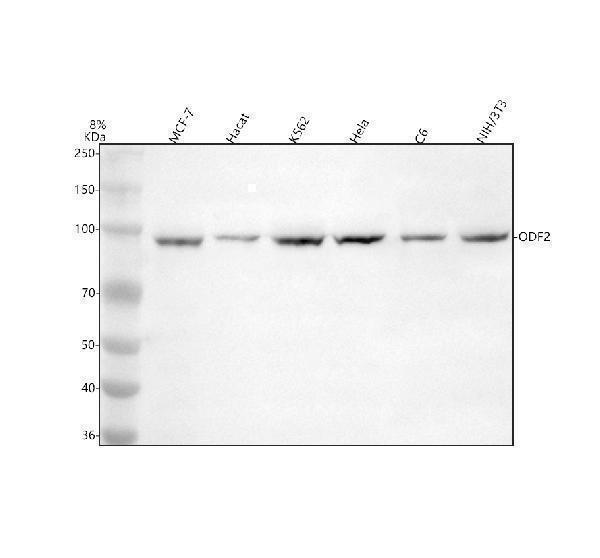  Western blot analysis of ODF2 using anti-ODF2 antibody (A05599-3)