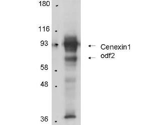 Anti-Cenexin-1 in Western Blot using Boster Immunochemical's Protein A Purified Anti-Cenexin-1 antibody shows detection of Cenexin-1 in total cell lysates from mouse F9 embryonic carcinoma cells