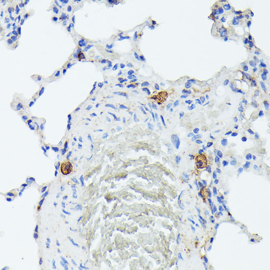 a05600 tial1 primary antiboties ihc testing 2