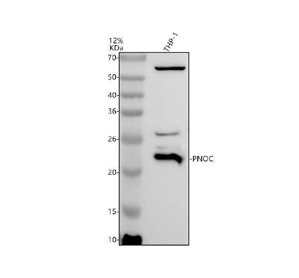 Western blot analysis of PNOC using anti-PNOC antibody (A05605-2)