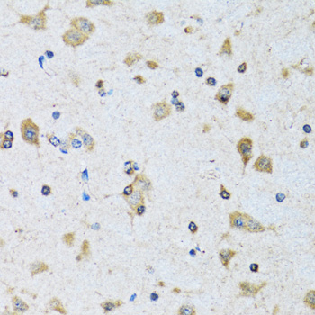 Immunohistochemistry of paraffin-embedded rat brain using PDP1 antibody  at dilution of 1:100 