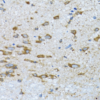 Immunohistochemistry of paraffin-embedded mouse spinal cord using PDP1 antibody  at dilution of 1:100 