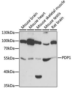 Western blot analysis of extracts of various cell lines, using PDP1 antibody  at 1:1000 dilution