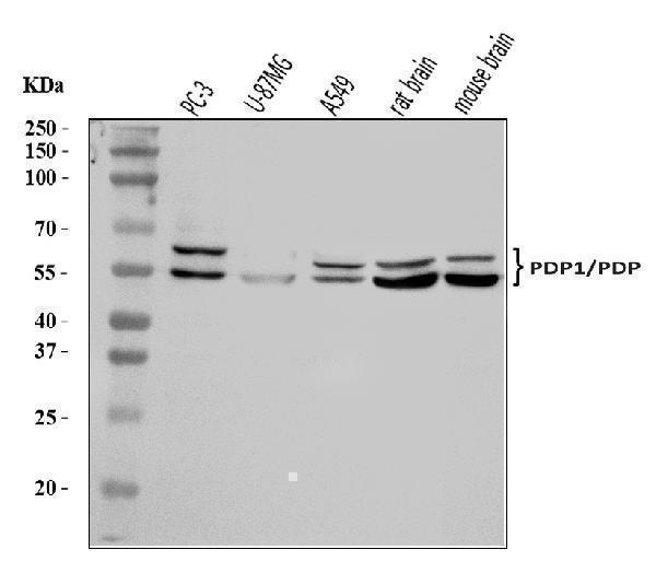  Western blot analysis of PDP1/PDP using anti-PDP1/PDP antibody (A05607-2)