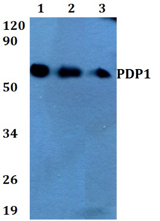 Western blot (WB) analysis of PDP1 polyclonal antibody at 1:500 dilution
Lane1:A549 whole cell lysate
Lane2:sp2/0 whole cell lysate 
Lane3:MCF-7 whole cell lysate 