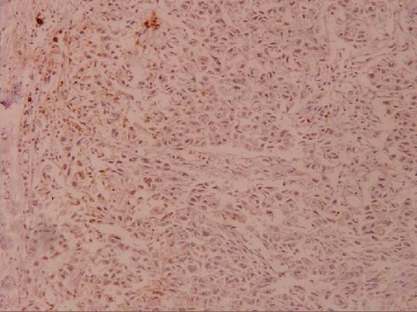 a05609 jund primary antiboties ihc testing 2