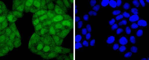 a05609s255 1 jund primary antiboties icc testing 2