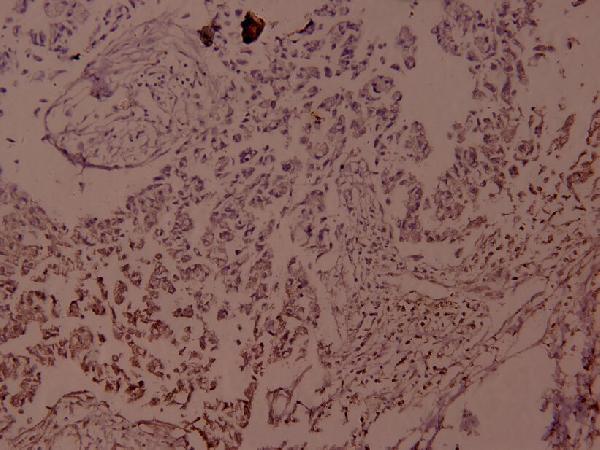 a05609s255 jund primary antiboties ihc testing 2