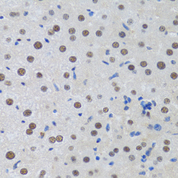 a05612 mta3 primary antiboties ihc testing 1