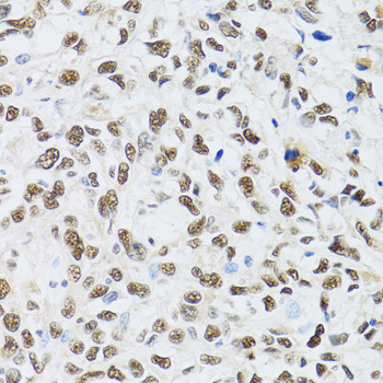 a05612 mta3 primary antiboties ihc testing 2