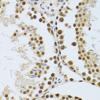 a05612 mta3 primary antiboties ihc testing 3