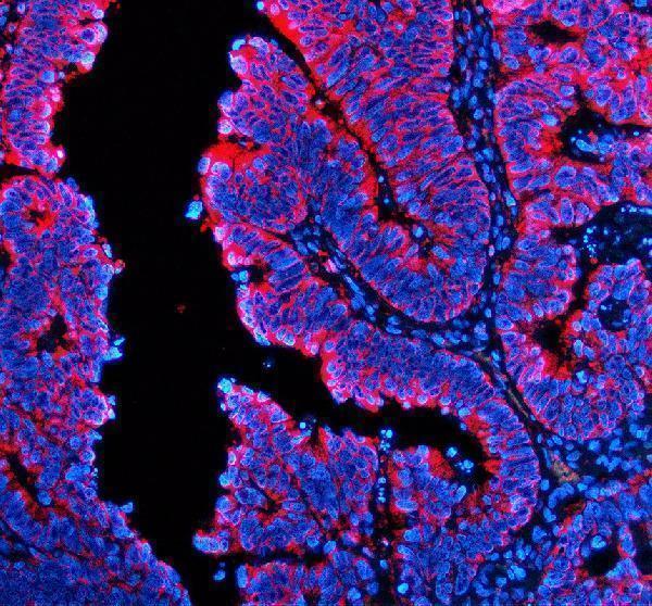 IF analysis of TRIOBP using anti-TRIOBP antibody (A05614-1)
