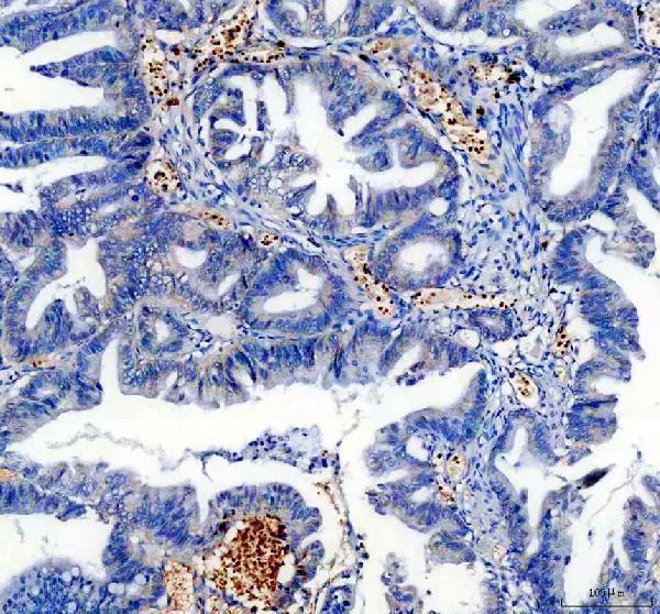 IHC analysis of TRIOBP using anti-TRIOBP antibody (A05614-1)