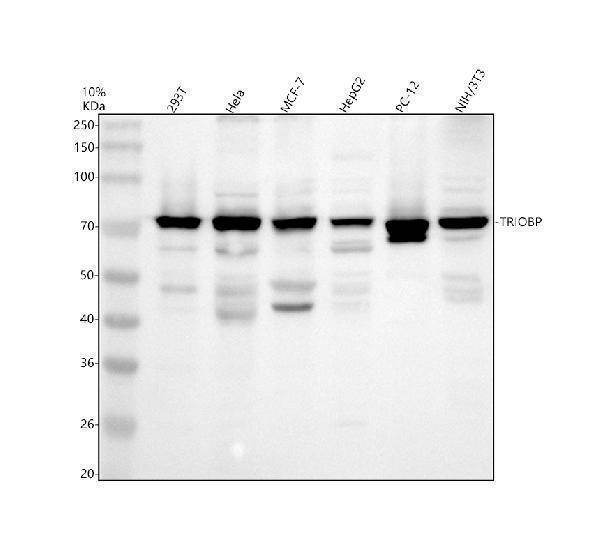 Western blot analysis of TRIOBP using anti-TRIOBP antibody (A05614-1)