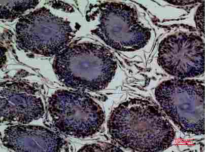 a05615 enpp3 primary antibodyes ihc testing 4