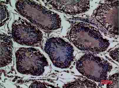 a05615 enpp3 primary antibodyes ihc testing 5