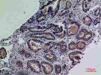 a05615 enpp3 primary antibodyes ihc testing 6