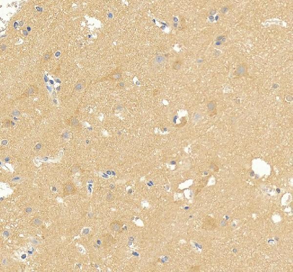 a05616 2 dnajc6 primary antibodies ihc testing 3
