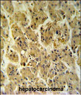 a05618 1 anti ndufs2 antibody center ihc p testing 2