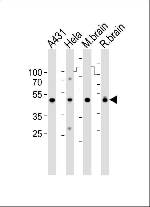a05618 1 anti ndufs2 antibody center wb testing 1