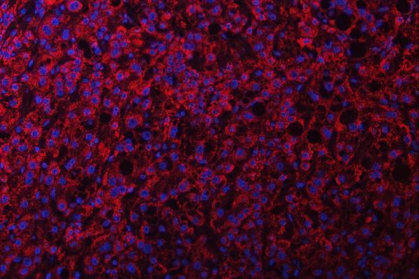 a05618 3 ndufs2 primary antibodies if testing 10