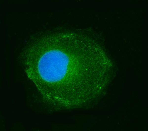 a05618 3 ndufs2 primary antibodies if testing 8