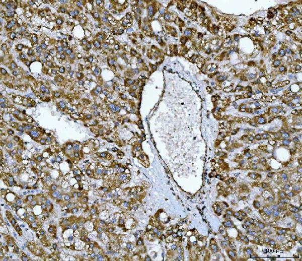  IHC analysis of NDUFS2 using anti-NDUFS2 antibody (A05618-3)