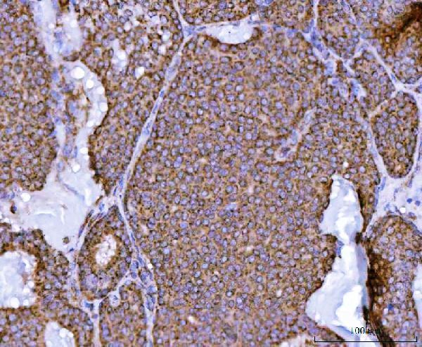  IHC analysis of NDUFS2 using anti-NDUFS2 antibody (A05618-3)