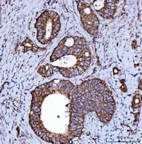a05618 3 ndufs2 primary antibodies ihc testing 4