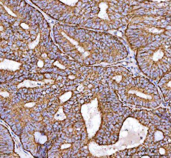 a05618 3 ndufs2 primary antibodies ihc testing 5
