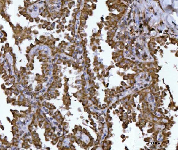 a05618 3 ndufs2 primary antibodies ihc testing 6