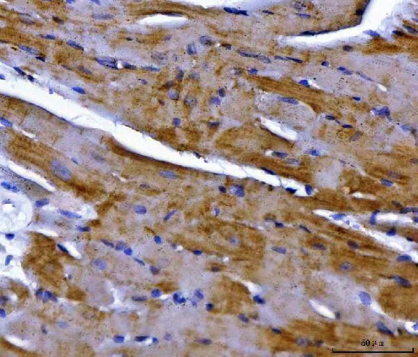 a05618 3 ndufs2 primary antibodies ihc testing 7