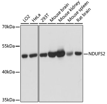 a05618 ndufs2 primary antiboties wb testing 1