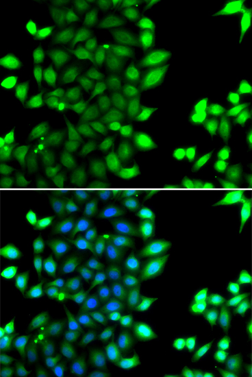 Immunofluorescence analysis of MCF-7 cells using RNF7 antibody 