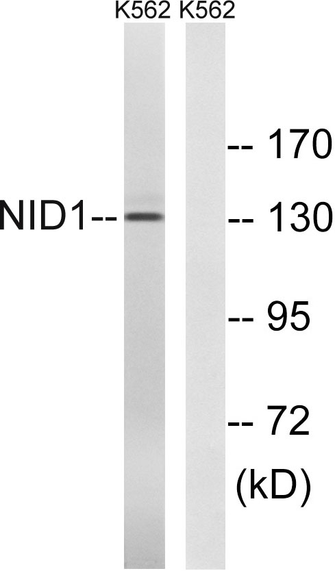 Western blot analysis of lysates from K562 cells, using NID1 Antibody