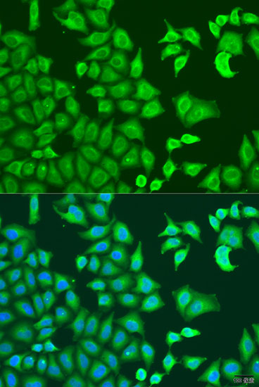 Immunofluorescence analysis of U2OS cells using CAPZB antibody  at dilution of 1:100