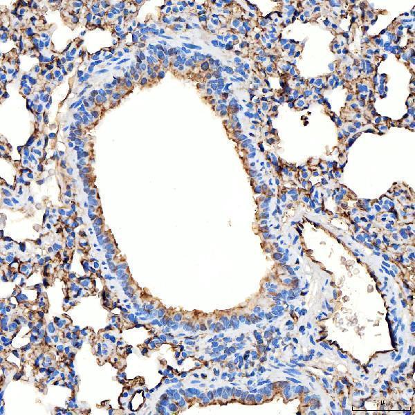 a05624 2 slc9a3r2 primary antibodies ihc testing 10