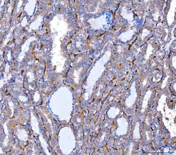  IHC analysis of SLC9A3R2 using anti-SLC9A3R2 antibody (A05624-2)