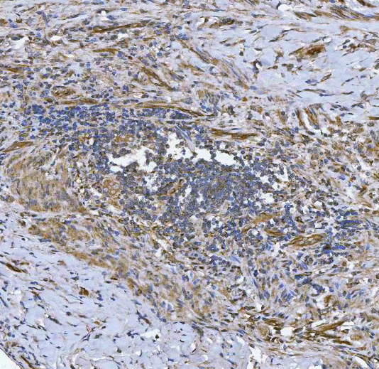  IHC analysis of SLC9A3R2 using anti-SLC9A3R2 antibody (A05624-2)