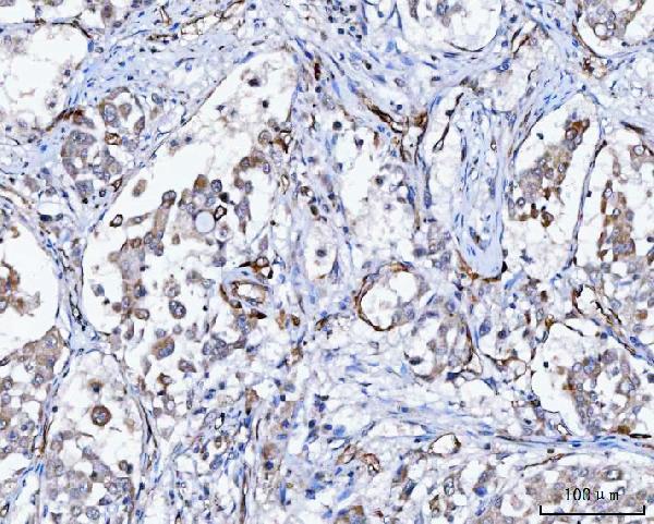 a05624 2 slc9a3r2 primary antibodies ihc testing 4