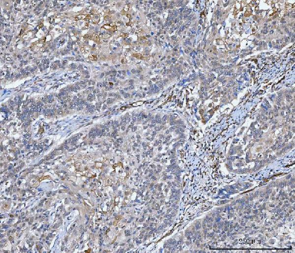 a05624 2 slc9a3r2 primary antibodies ihc testing 5