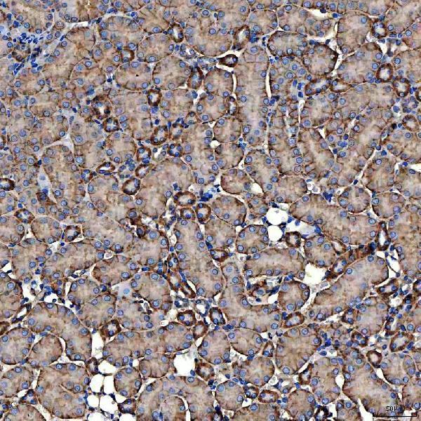 a05624 2 slc9a3r2 primary antibodies ihc testing 6