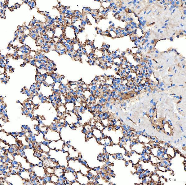 a05624 2 slc9a3r2 primary antibodies ihc testing 7