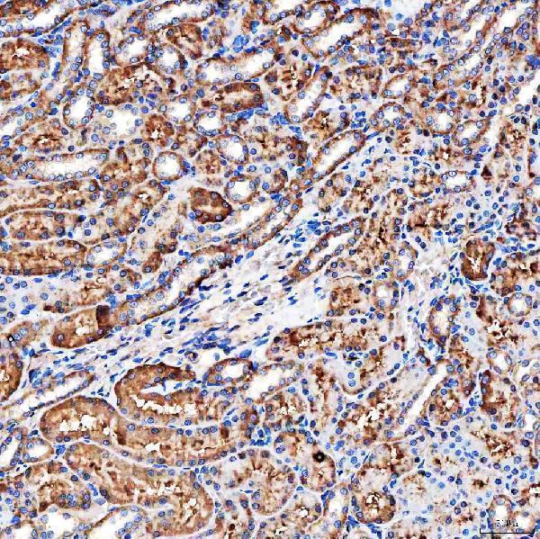 a05624 2 slc9a3r2 primary antibodies ihc testing 8