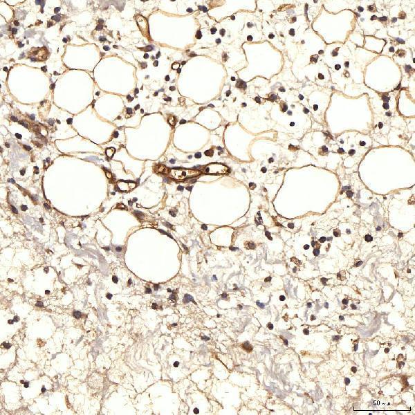 a05624 2 slc9a3r2 primary antibodies ihc testing 9